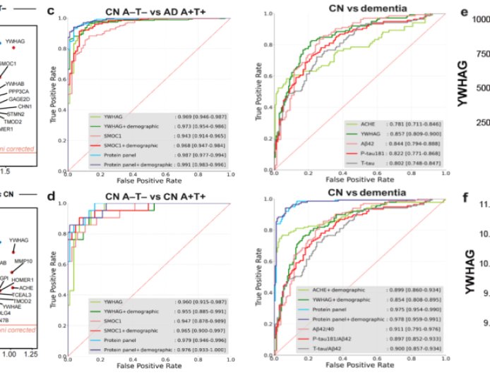 复旦大学研发新型早筛早诊检测试剂，突破性提前 15 年预测阿尔茨海默病发病风险
