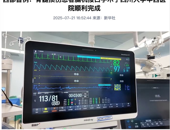 西部首例：四川大学华西医院顺利完成脊髓损伤患者脑机接口手术，可脑控机械手