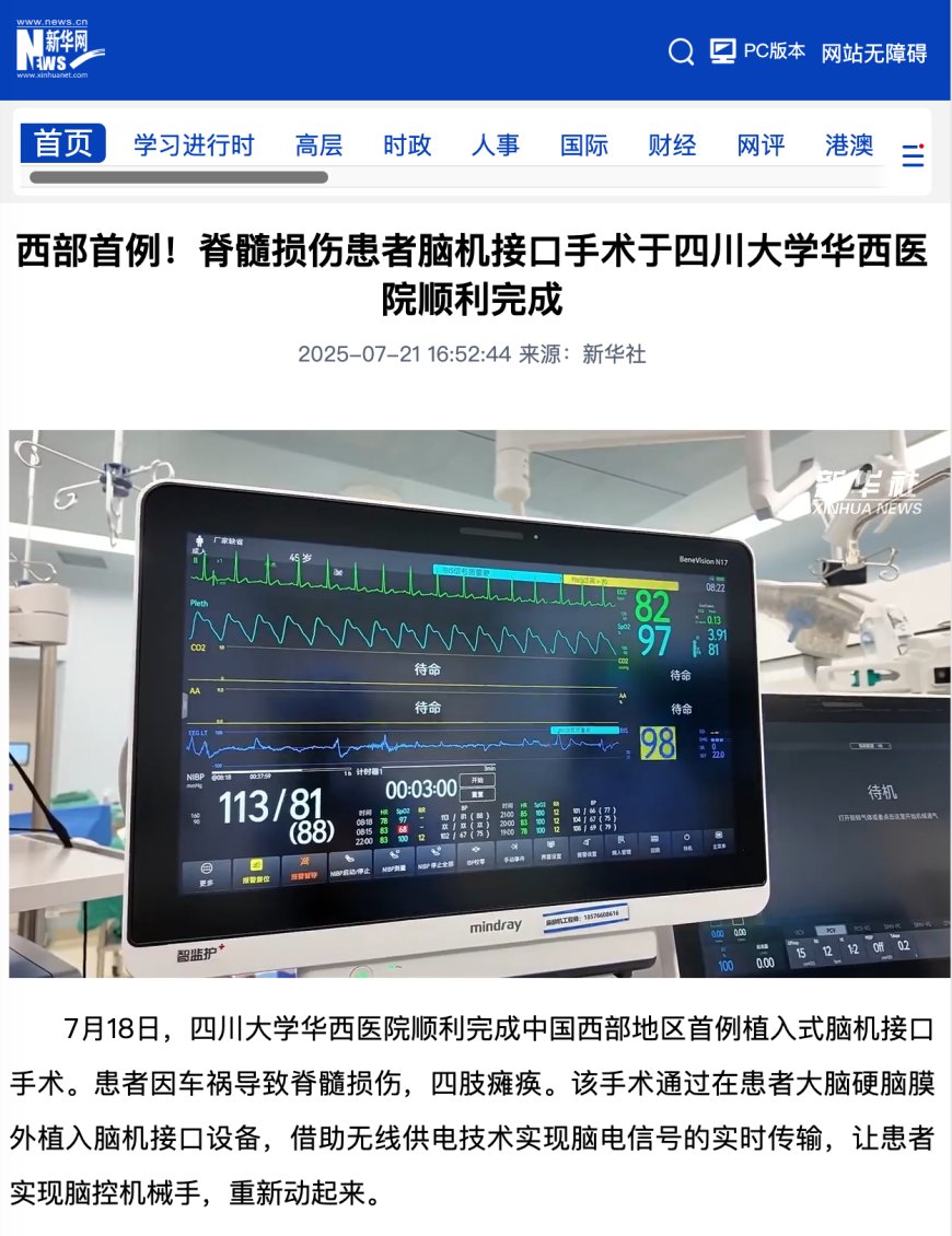 西部首例:四川大学华西医院顺利完成脊髓损伤患者脑机接口手术,可脑控机械手
