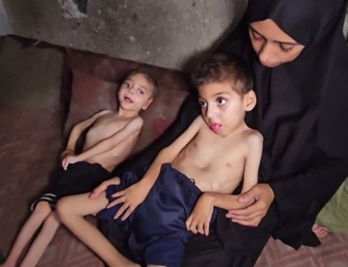 孩子问我，世界为何让我们挨饿？