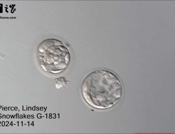 美国冷冻超 30 年胚胎成功孕育男婴