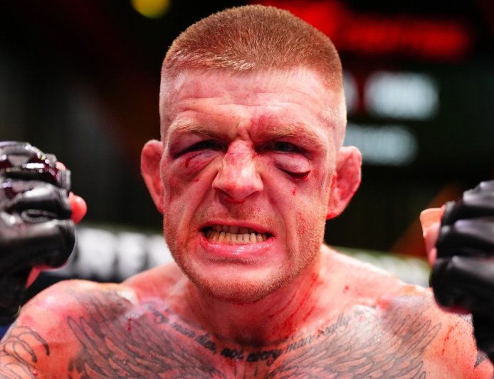 ‘This is nothing’ – UFC star opens up on childhood after being left unrecognisable in Las Vegas war