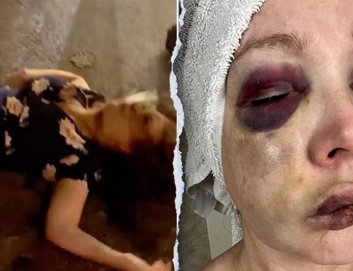 Cincinnati beatdown victim reveals 'very bad brain trauma' in first remarks since viral assault