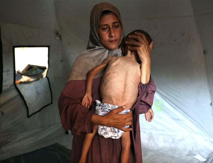 NY Times' erroneous cover photo of Gazan child joins series of media blunders framing stories against Israel