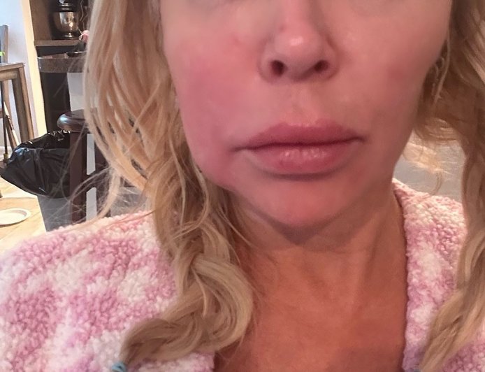 Everything Brandi Glanville Has Said About Her Facial Disfigurement
