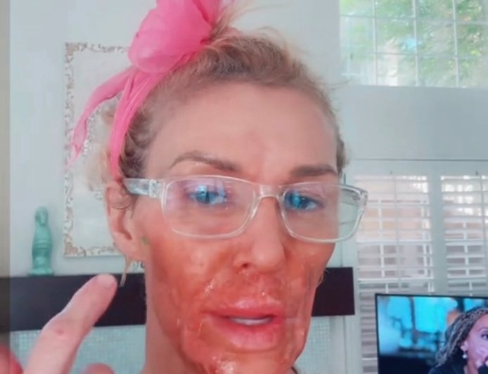Brandi Glanville Seemingly Burns Herself After Putting Nair on Her Face