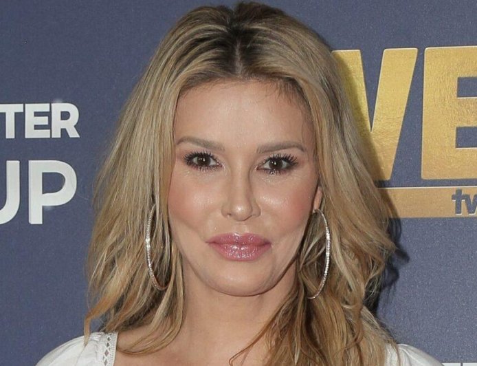 Brandi Glanville Suffers Severe Chemical Burns After Attempting To Remove Facial Parasite With Nair