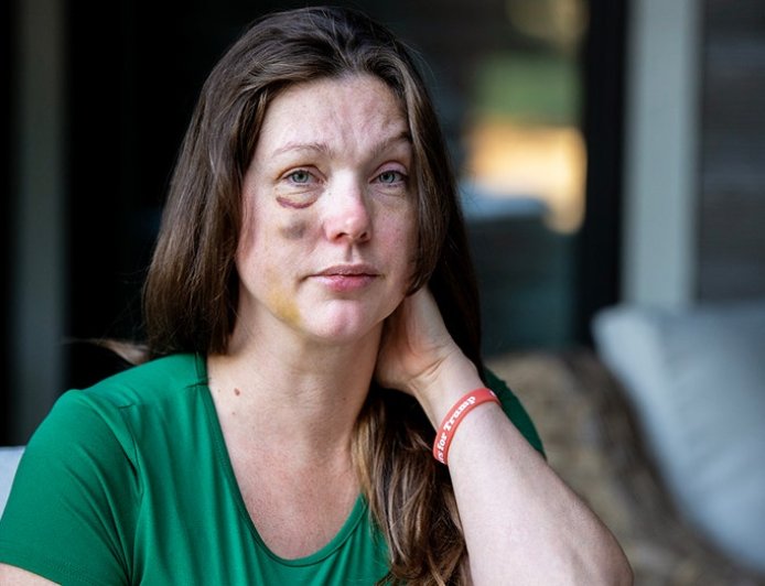 Cincinnati viral beating victim says violent mob started attacking 'like a pack of wolves'