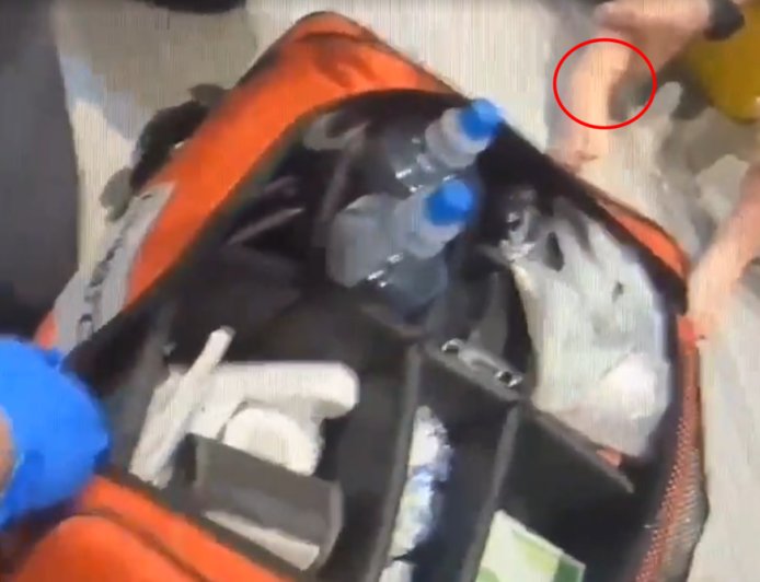 社區遊戲室有毒蛇出沒！基隆5歲童遭龜殼花攻擊　雙腿咬出洞嚎哭