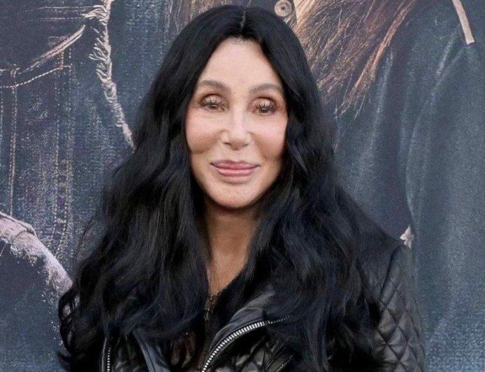 Cher Reportedly Sparks Plastic Surgery Concerns As 'It's Really Catching Up To Her'