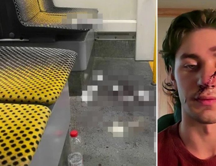 American stabbed defending women on German tram criticizes immigration policies after suspect released
