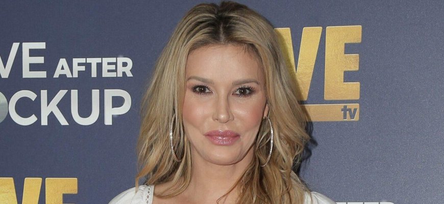 Brandi Glanville Suffers Severe Chemical Burns After Attempting To Remove Facial Parasite With Nair