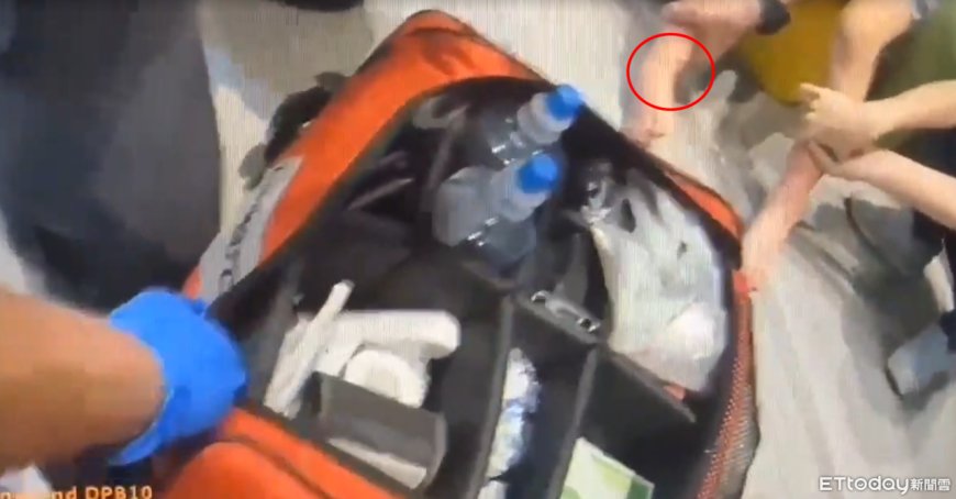 社區遊戲室有毒蛇出沒！基隆5歲童遭龜殼花攻擊　雙腿咬出洞嚎哭