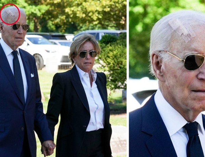 Biden spotted with giant bandage on head after having surgery to treat skin cancer