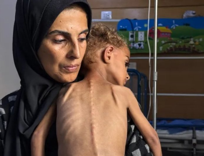 新的饥荒受害者与联合国报告员警告加沙饥荒蔓延