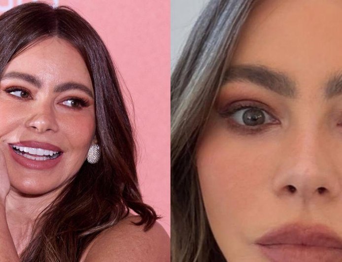 Sofia Vergara Missed Out on the 2025 Emmys Due to ER Visit for 'Craziest' Allergy That 'Looks Painful'