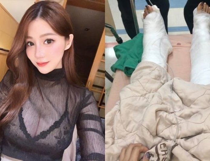 女網紅台東搭船遭「捲入螺旋槳」!美腿重傷留疤 船長挨告結果曝