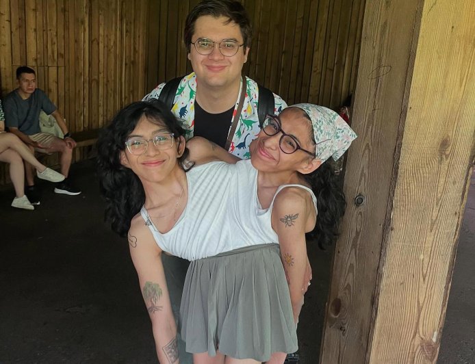 Conjoined Twins Carmen and Lupita Andrade Reveal How They Navigate Intimacy