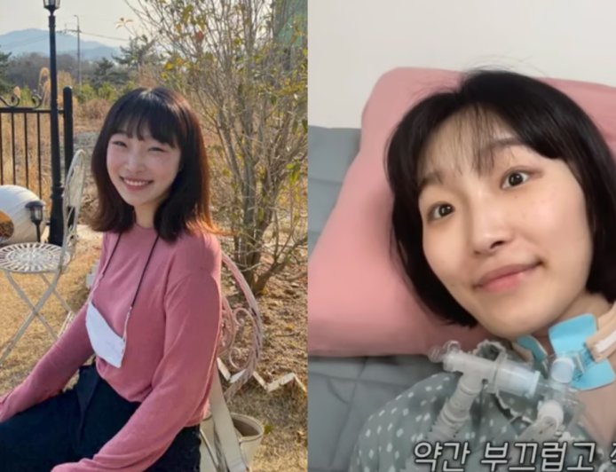 腳無力查不出病因！韓網紅25歲確診漸凍症抗病6年 　家人證實病逝