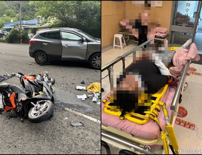 快訊/苗栗19歲騎士碰撞轎車 全身多處擦傷、右手骨折