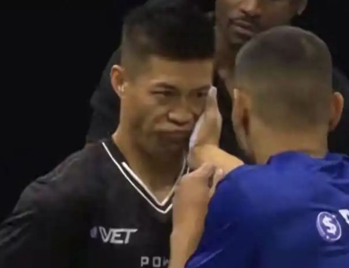 陸「通背拳」傳人打耳光比賽被3巴掌KO　休息5天現身：看人還是重影