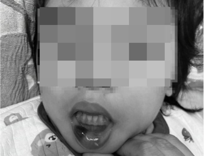 超扯！台東特教師狠虐6幼童「全身是瘀青」　校長調職加給照領