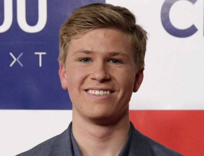 Robert Irwin Is Reportedly Nursing An Injury Ahead Of 'DWTS' Finale