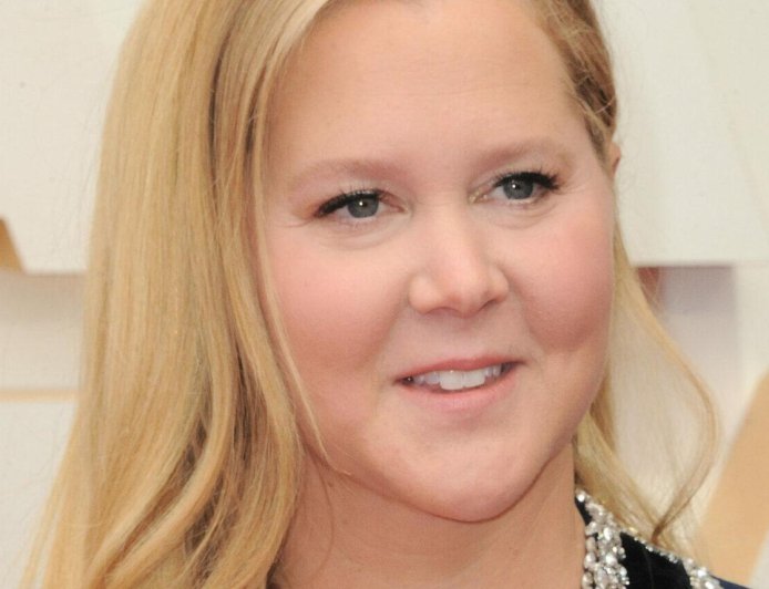 Amy Schumer's Facial Transformation Raises Eyebrows As Expert Weighs In On Possible Cosmetic Enhancements