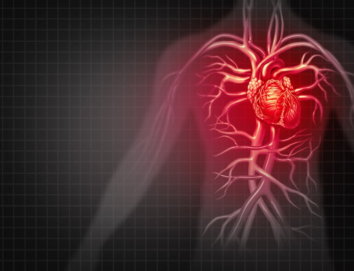傳統檢查漏抓6成心肌梗塞　研究：男性超過45歲就要警覺