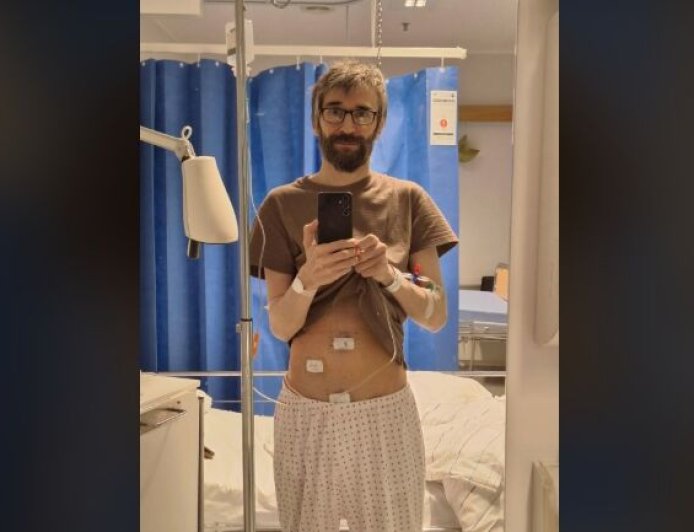 49歲男腹痛24小時遭誤診胃酸　Grok建議做斷層查出闌尾瀕臨破裂