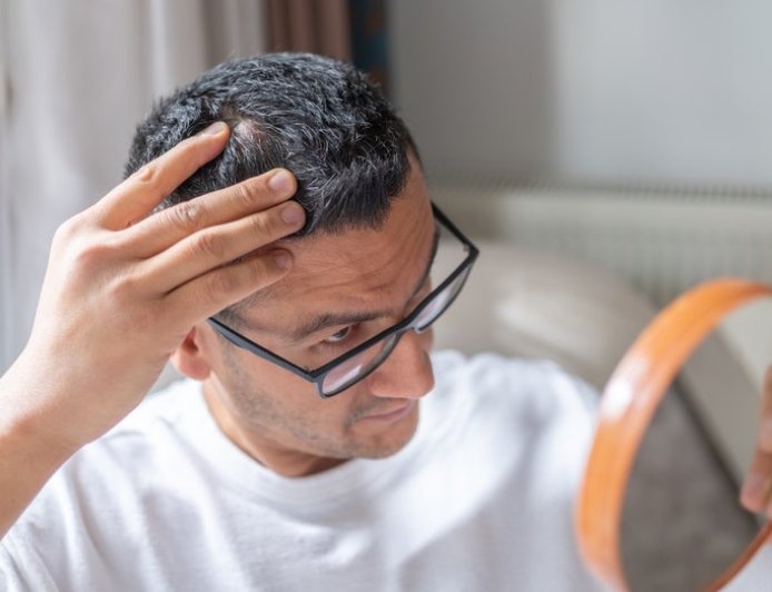 New baldness treatment shows dramatic hair-regrowth gains in major trial