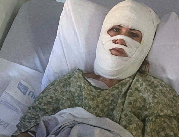 Georgia woman hospitalized after attacker hurls corrosive chemical during evening walk