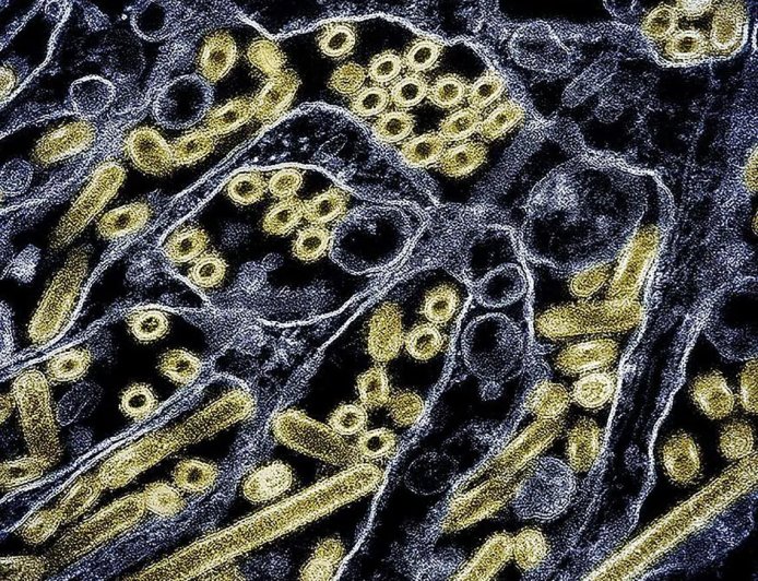 290万人次感染 美国流感活动水平上升