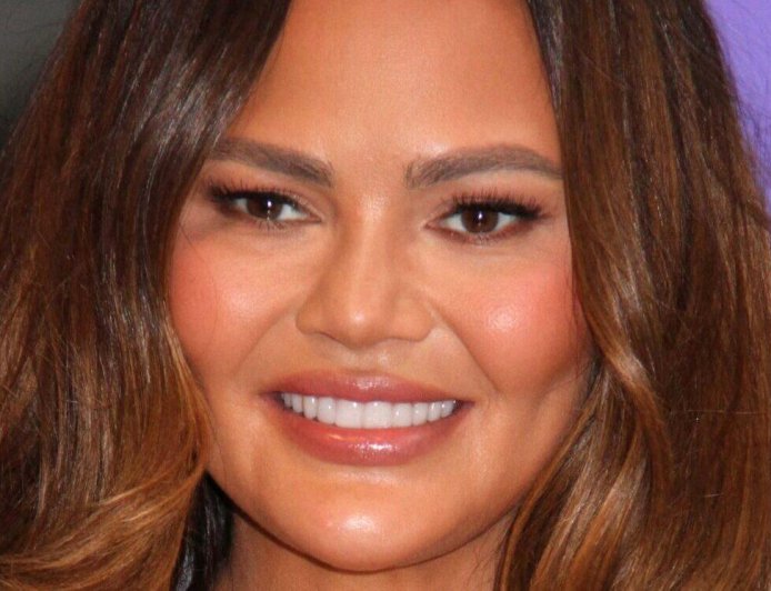 Chrissy Teigen Suffers Chipped Tooth After Candy Cane Game Goes Wrong