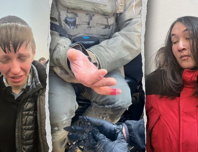 Anti-ICE agitator allegedly bites off federal officer's finger during Minneapolis attack