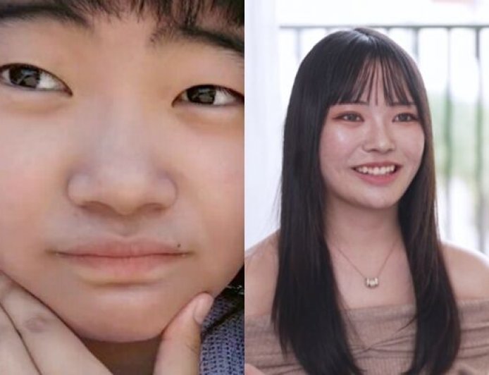 被前男友羞辱醜！21歲櫻花妹砸19萬整形重生　換臉對比照曝