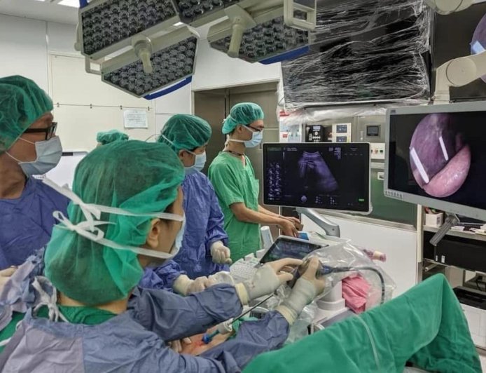 長庚醫療團隊完成罕見「胎兒內視鏡脊柱裂修補微創手術」 成功扭轉胎兒命運