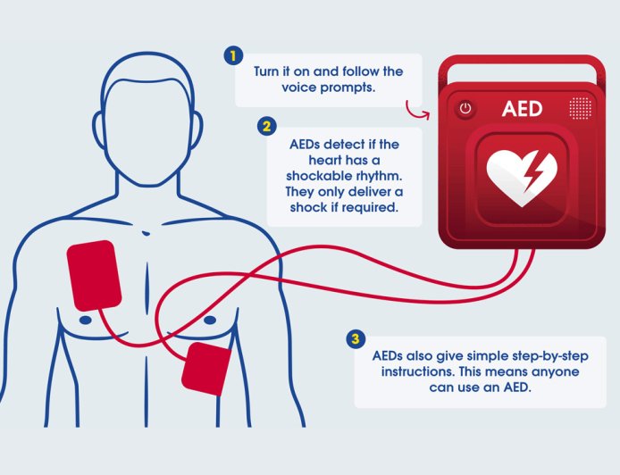 为 AED 精准度进行全国统一“标尺”考核，我国心脏除颤器校准装置计量比对工作完成